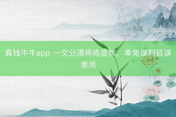 真钱牛牛app 一文分清痔疮症状,幸免误判延误崇尚