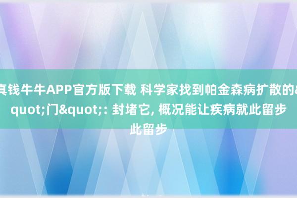 真钱牛牛APP官方版下载 科学家找到帕金森病扩散的"门": 封堵它, 概况能让疾病就此留步